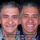 Slider image (7) Odontologia Laser